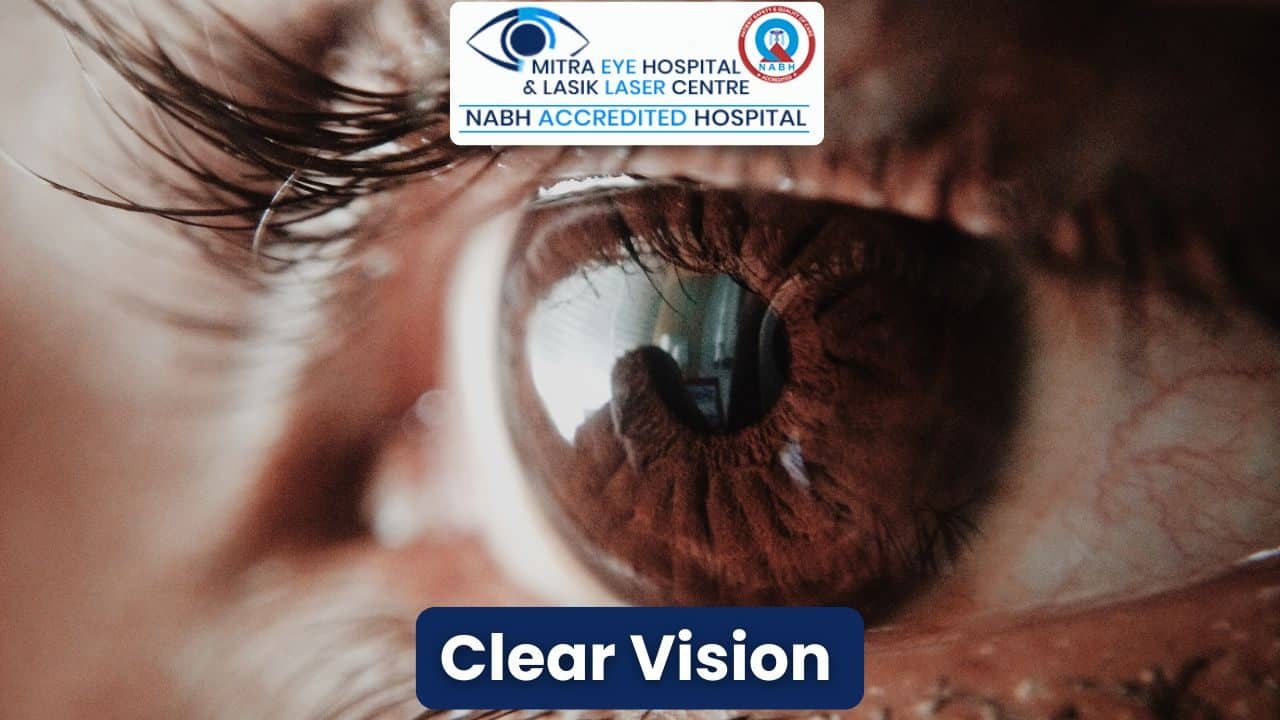 High-resolution close-up of a human eye showing clear vision after LASIK eye surgery at Punjab LASIK center.