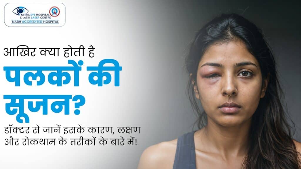 Close-up of woman with swollen eyelid, eye injury or allergy symptoms.
