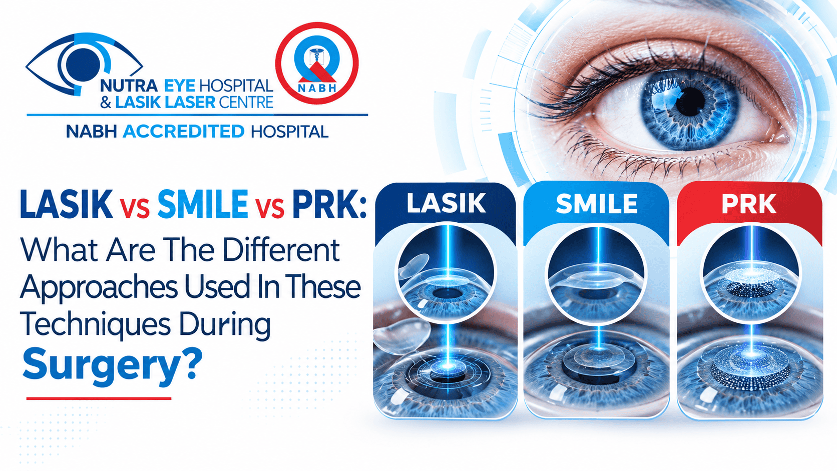 Punjab Lasik eye surgery comparison LASIK SMILE PRK image.